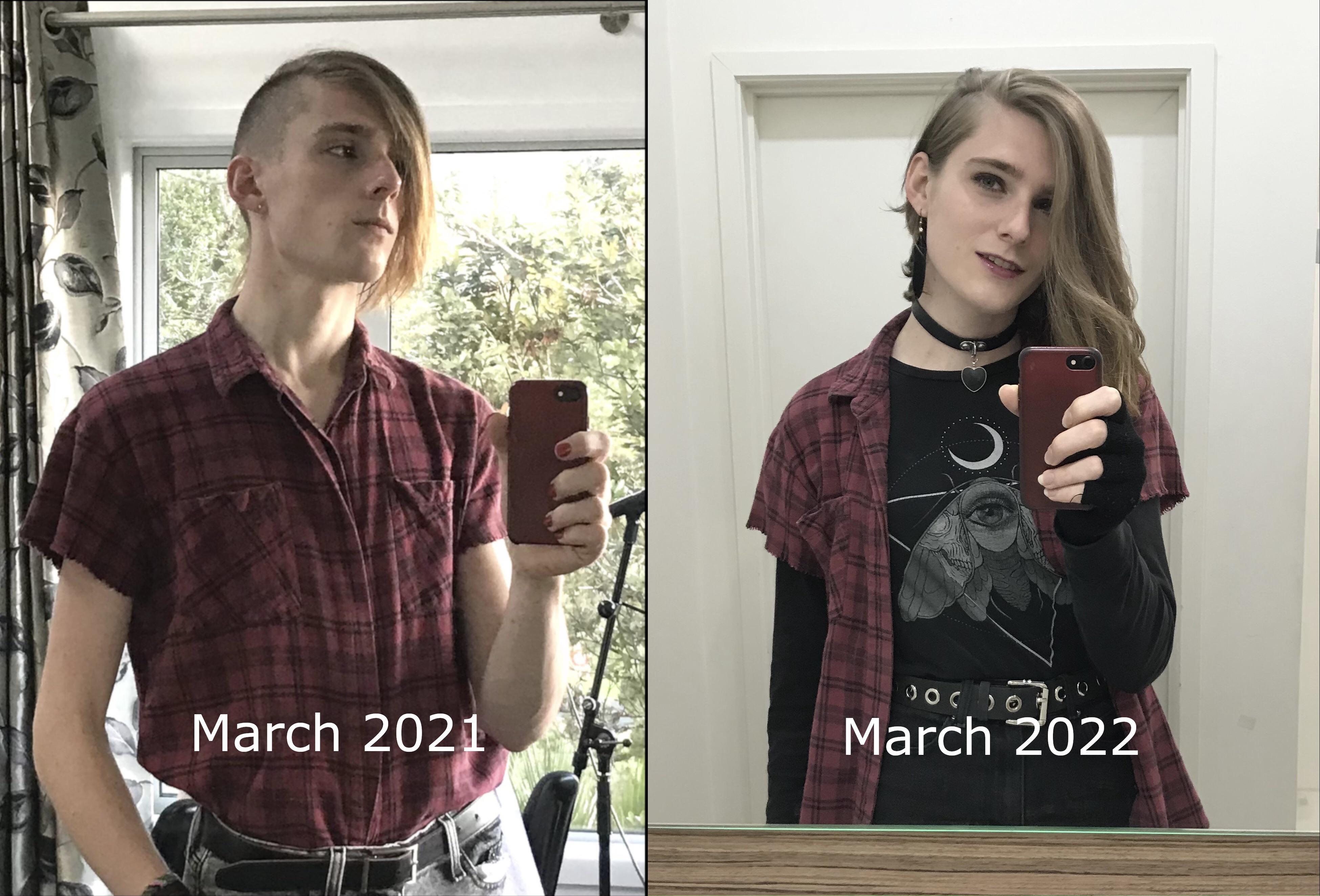 Операция трансгендеров фото. Трансгендеры до и после. Трансгендеры фото после операции. Трансгендеры России фото до и после. Перевоплощение в трансгендера.